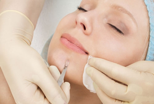 Limpieza facial  profunda 