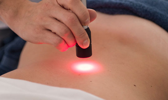 TRATAMIENTOS CON LASER