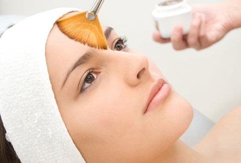 Peeling químico